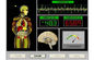 Κβαντική συσκευή ανάλυσης υγείας σώματος, συσκευή ανάλυσης σύνθεσης σώματος ah-Q1 προμηθευτής