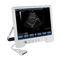 TS20 ψηφιακό διαγνωστικό σύστημα υπερήχου για το τμήμα μαιευτικής και γυναικολογίας προμηθευτής